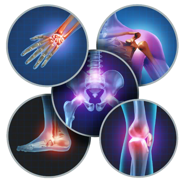 Articulations